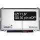 Display-ul notebook-ului Slim TB11,6“ 30pin HD LED Slim - Lucios