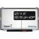 Display-ul notebook-ului Acer Aspire V5-123-12104G32NSS11,6“ 30pin HD LED Slim - Matt