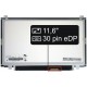 Display-ul notebook-ului Toshiba Satellite L15-B133011,6“ 30pin HD LED Slim - Lucios
